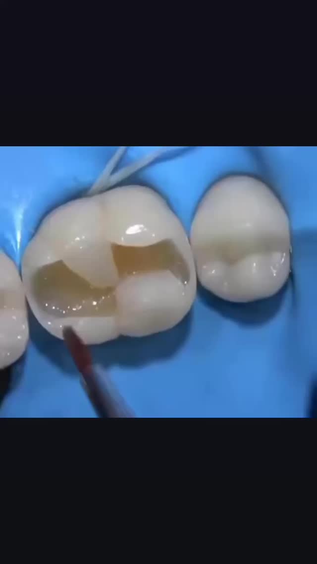 Стоматология — брекеты