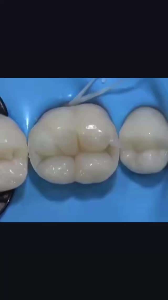 Удаление зубов Бишкек