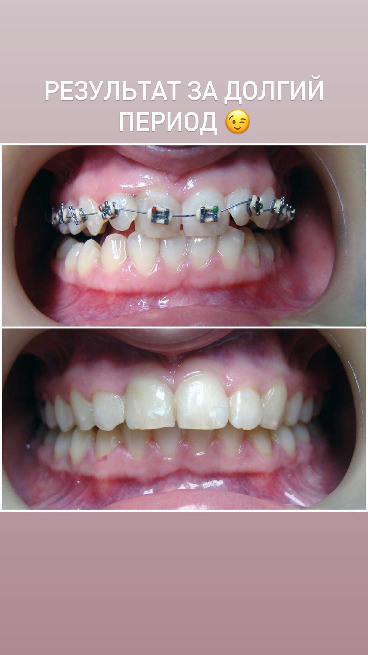 Чекап организма